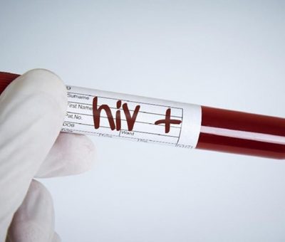 Resmi Buka Bank Sperma Positif HIV Pertama di Dunia